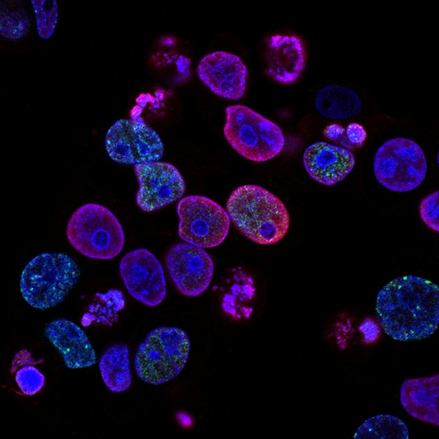 Cellular structures under microscope representing mitochondrial research